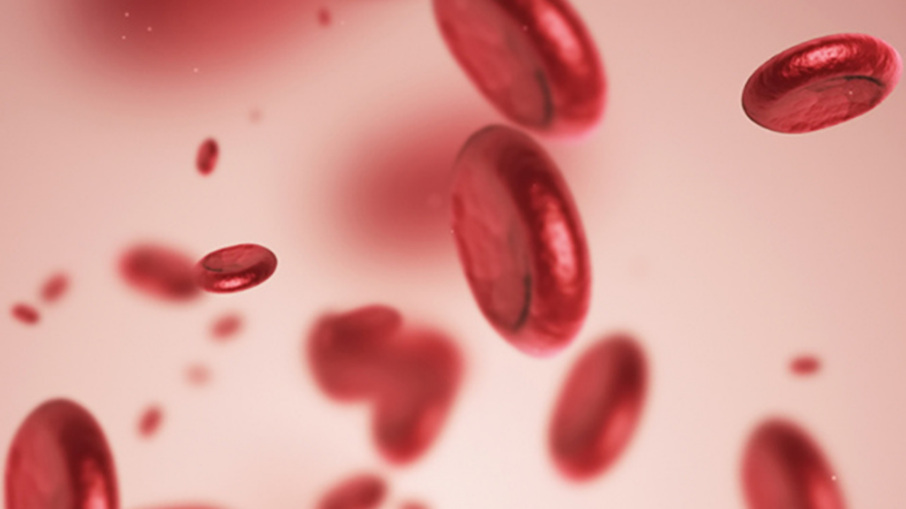 Sepsis and Medical Negligence Claims